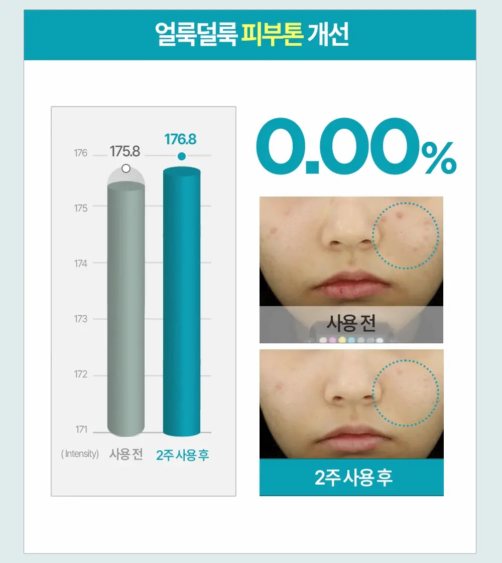 [열감진정] 더마토리 시카 엑소좀 흔적 진정 거즈 토너패드 70매+10매 기획 상세페이지 29